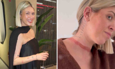 Influencer faz alerta após quase ser "decapitada" por lenço que ficou preso debaixo de carro em movimento
