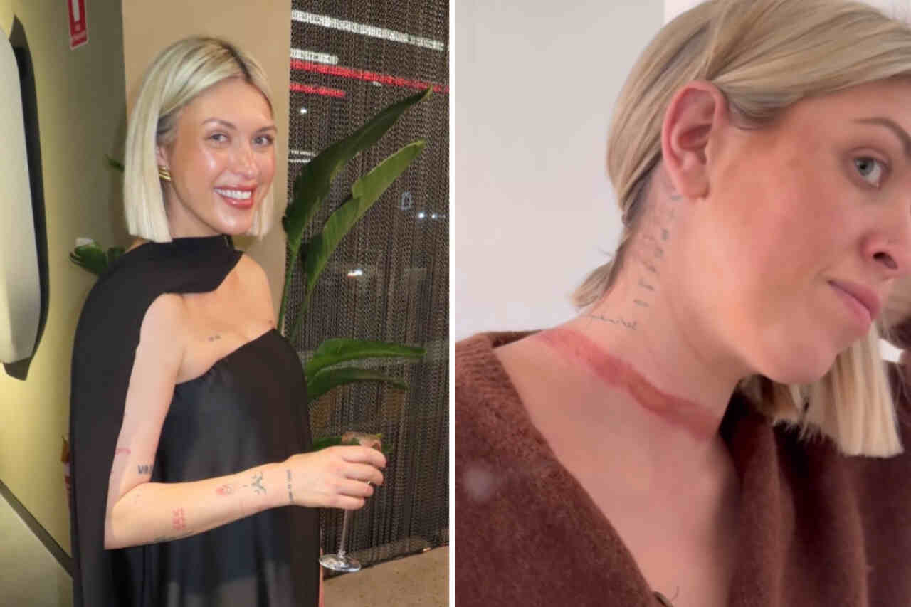 Influencer issues warning after nearly being 'decapitated' by scarf caught under moving car